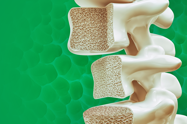 Integrative approach to osteoporosis. Osteosarcopenia as a new systemic disease. Genetic determinants of osteoporosis, biomarkers and the basic mechanisms of its development. The opportunities offered by modern diagnostics, prevention and treatment approa